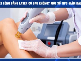 Triệt lông bằng công nghệ Diode laser ruby AI có đau không?