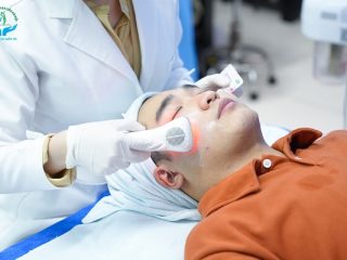 Cách trị mụn ở nam giới hiệu quả - chuẩn y khoa